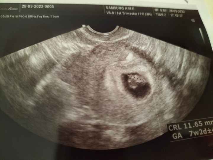 Metodo Ramzi 😂😉❤️ - 1