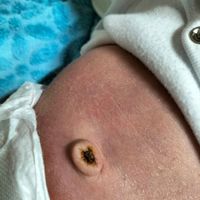 Future mamma novembre 2022 🍇🍁🧸 - 1