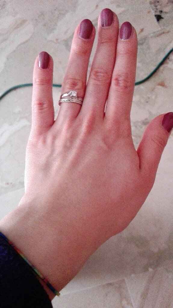 Anello: a me proprio non piace 👎 - 1