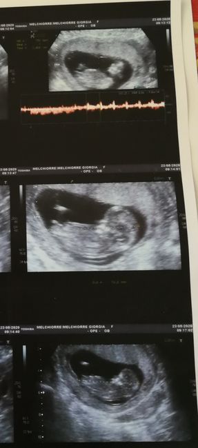 Esperte di Nub Theory ? - 1