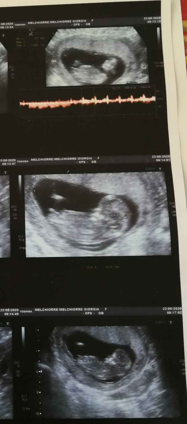 Esperte di Nub Theory ? 2