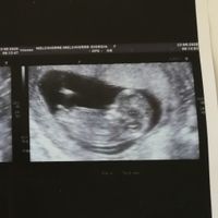 Esperte di Nub Theory ? - 1