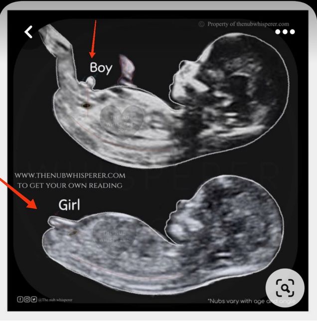 Nub theory maschio o femmina? Esperte chi mi aiuta 😄 3