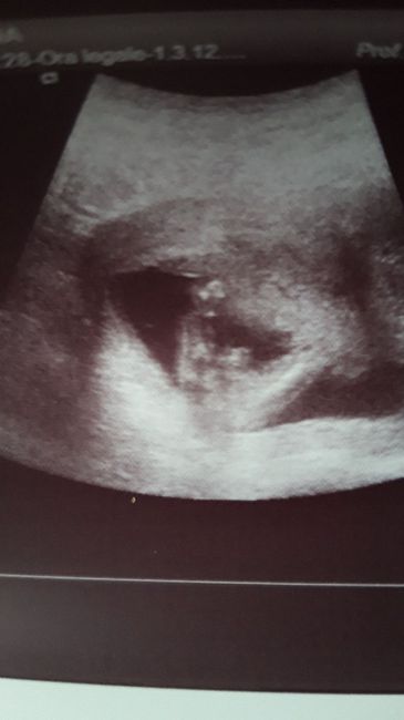 Future mamme maggio 2020 - 2