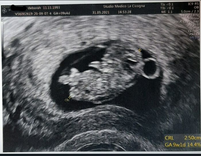 Future mamme di Gennaio 2022 - 1