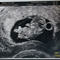 Future mamme di Gennaio 2022 - 1