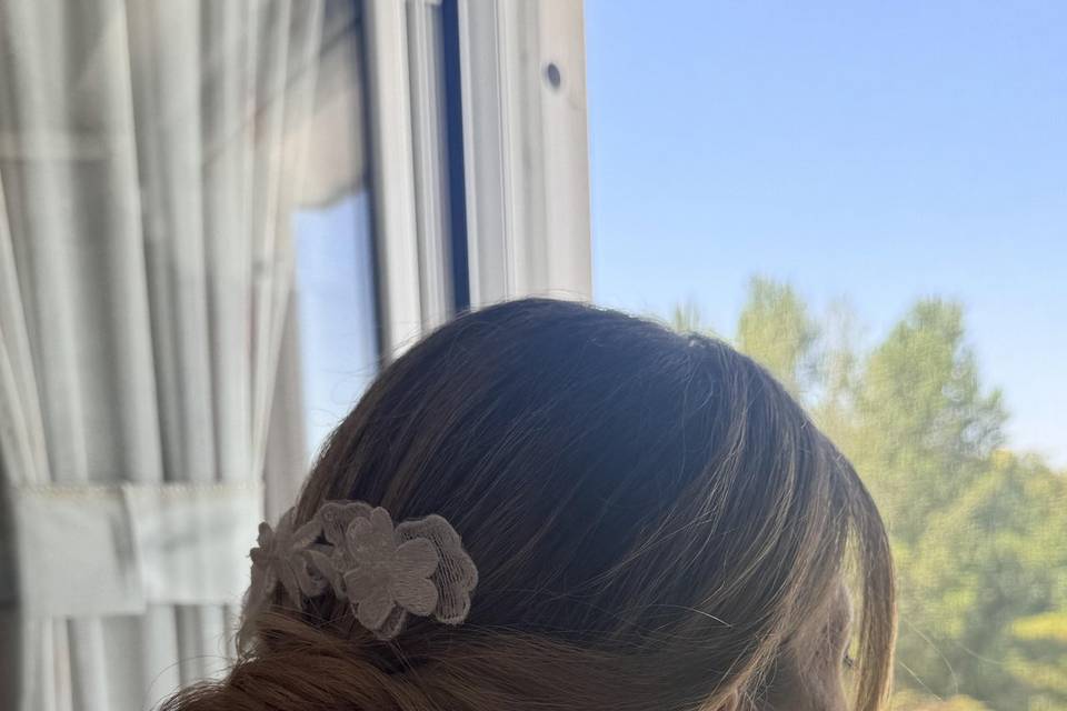 Hair on Top