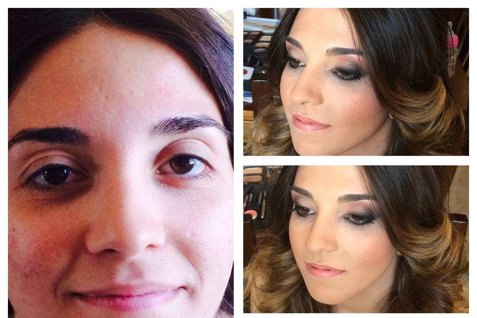 Trucco acne