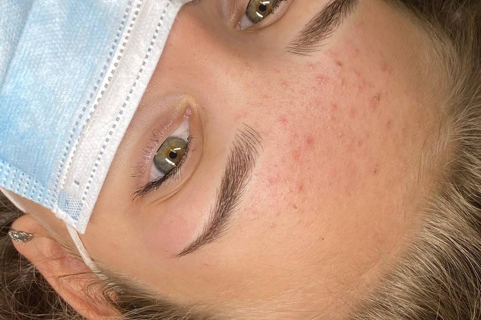 Microblading