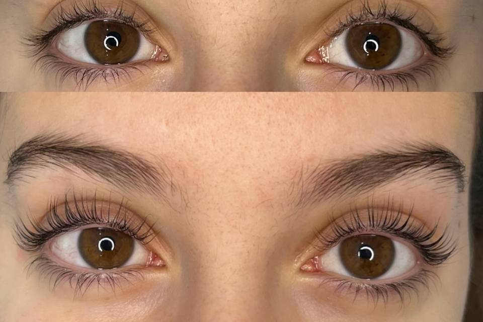 Prima e dopo