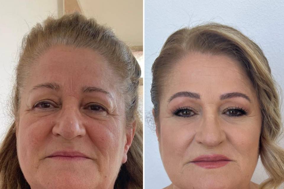 Prima/dopo