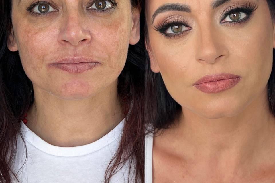Prima/dopo