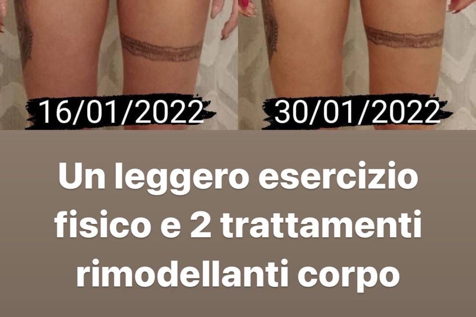 Rimodellamento corpo