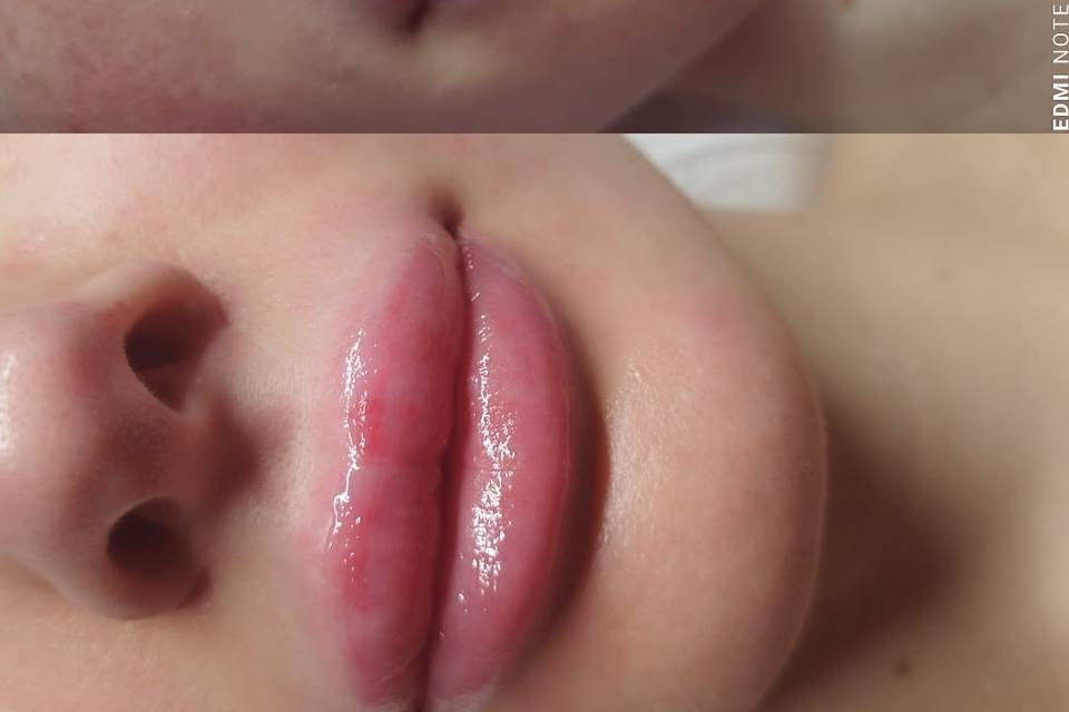 Kissum lips