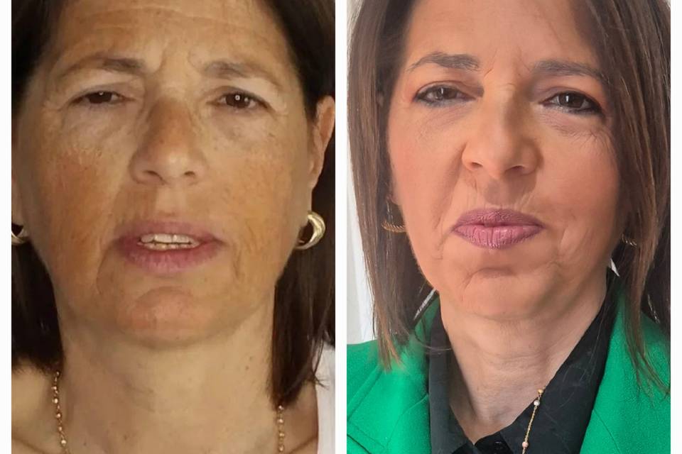 Prima e dopo per cerimonia