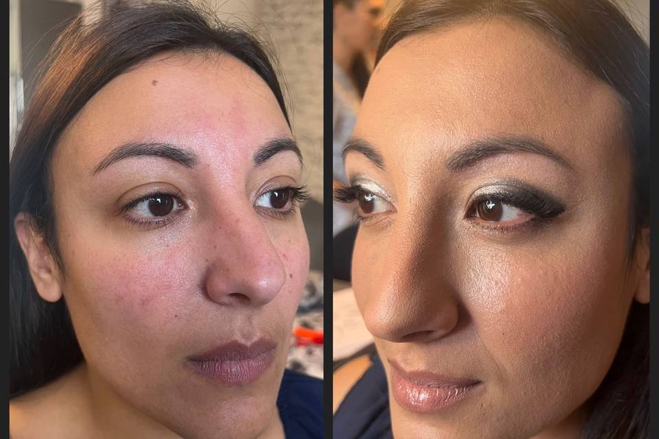 Prima e dopo