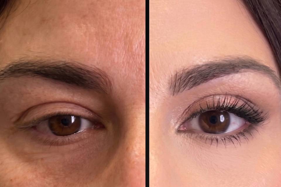 Prima e dopo