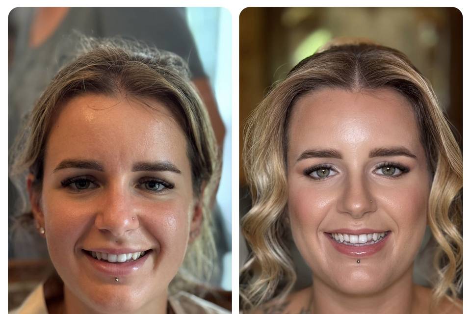 Prima dopo