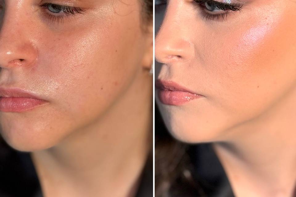 Prima e dopo