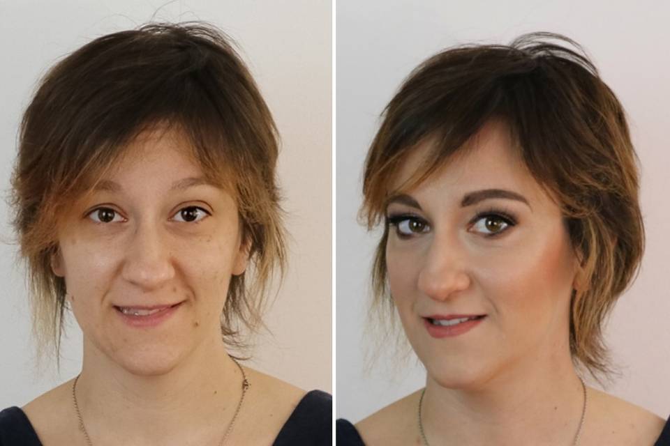 Correzione occhio incappucciat