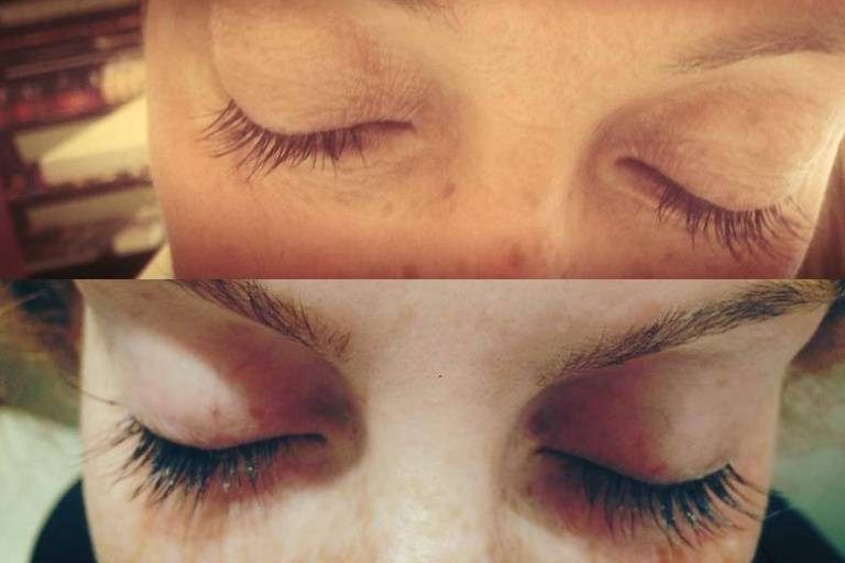 Extension ciglia