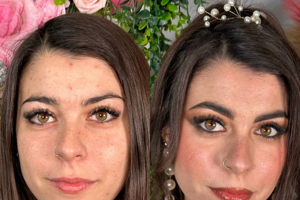 Pre e post