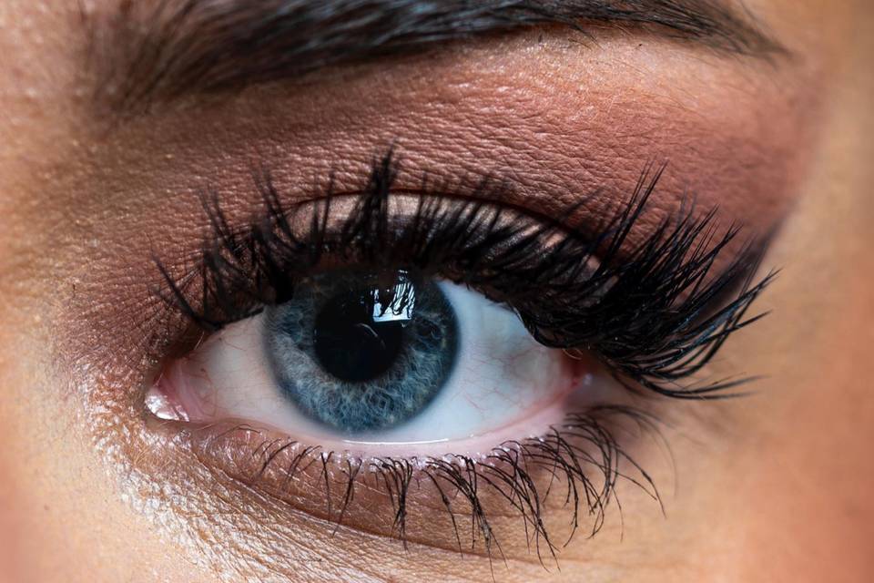 Eye