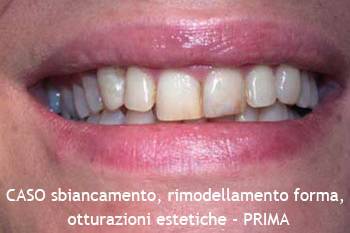 Studio Estetica Dentale - Antonella Udeschini