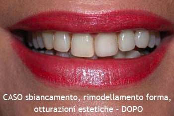 Studio Estetica Dentale - Antonella Udeschini