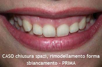 Studio Estetica Dentale - Antonella Udeschini