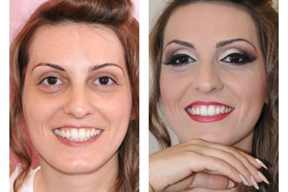 Prima&dopo make-up