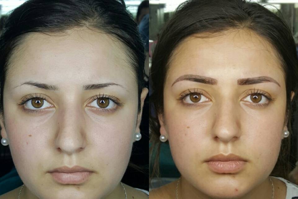 Microblading