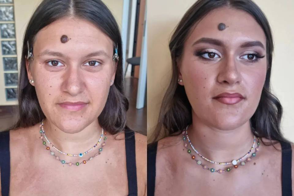Before and After