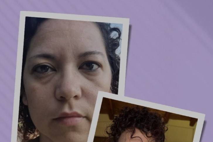 Prima/dopo