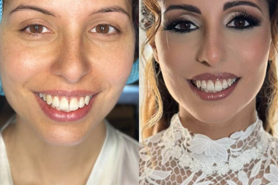 Prima e dopo