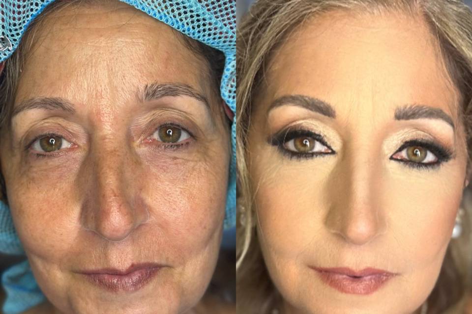Prima e dopo