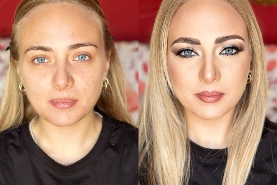 Prima e dopo