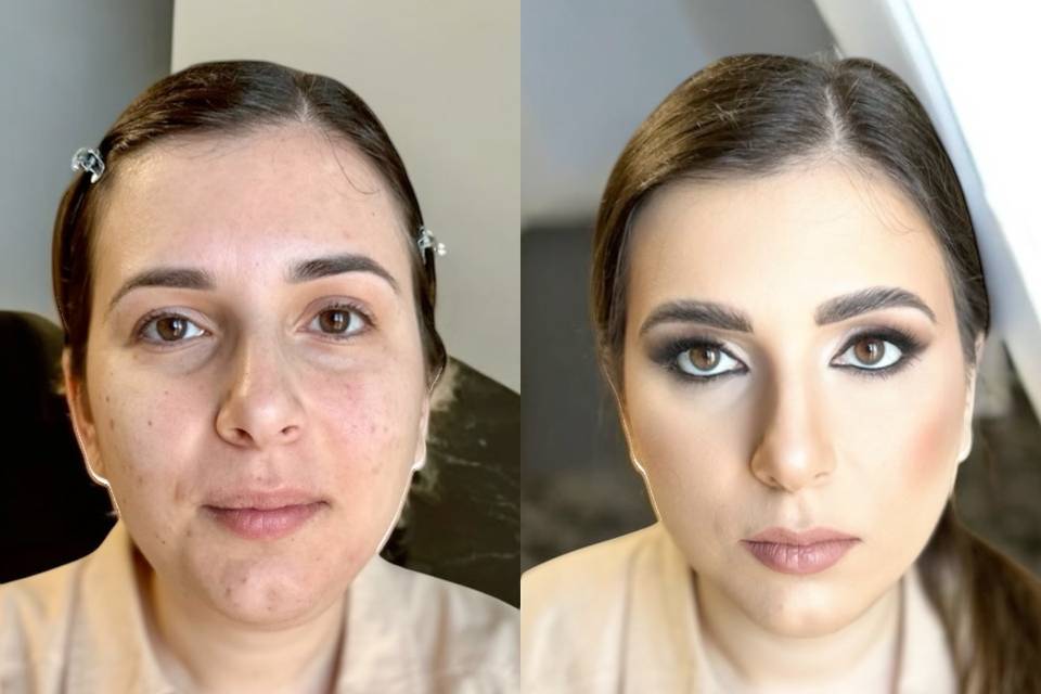 Prima e dopo