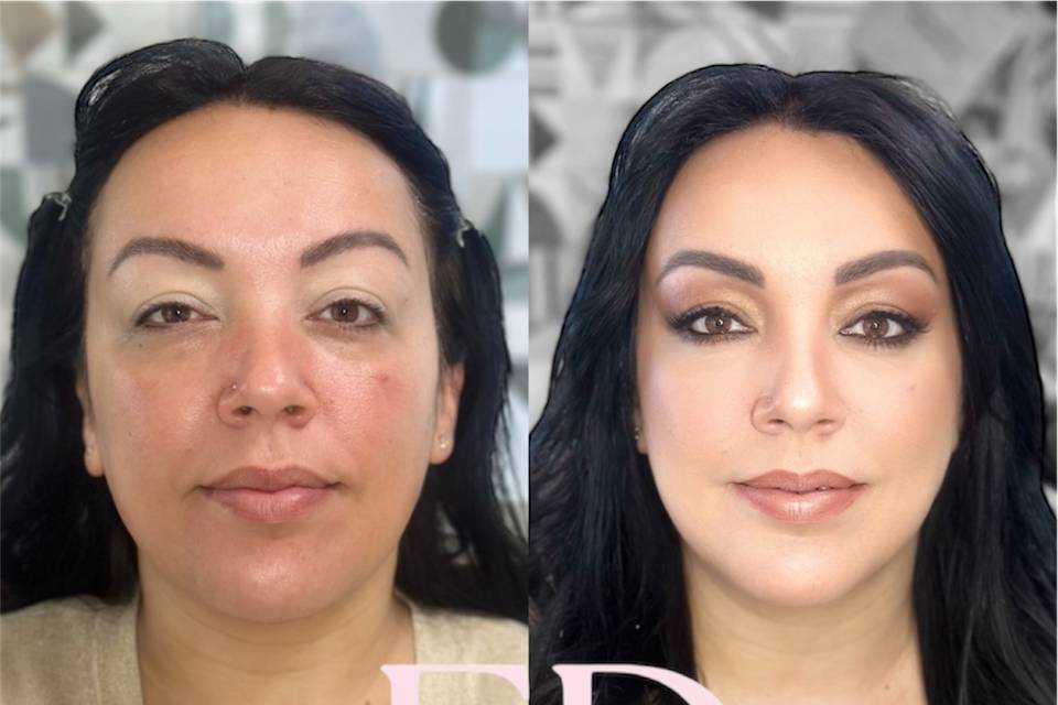 Prima e dopo