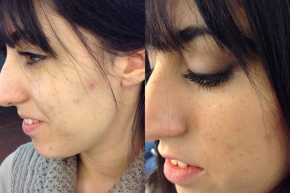 Trucco correttivo prima dopo