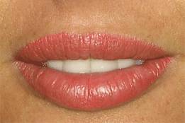 Riempimento mucosa liptattoo