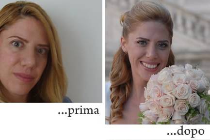 Emanuela prima e dopo