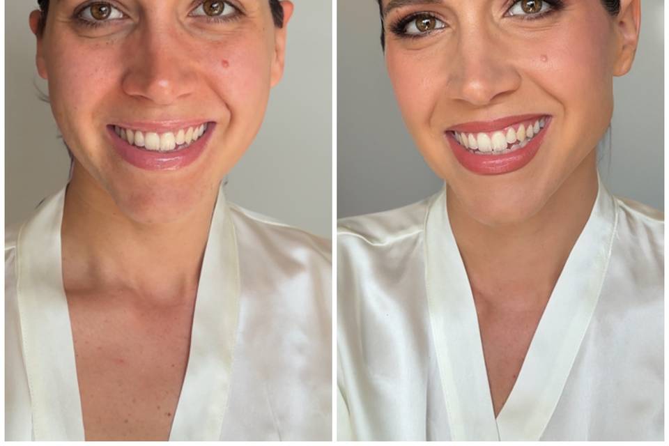 Before and After