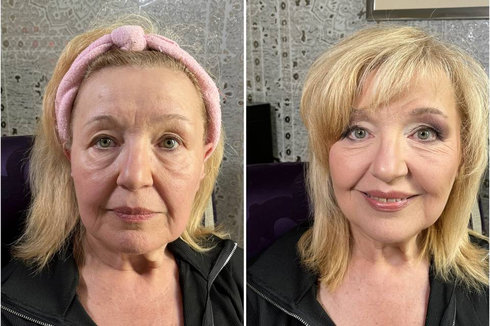 Prima e dopo anti-age