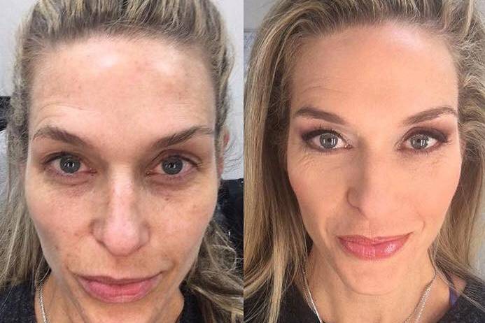 Prima e dopo per Jill Cooper