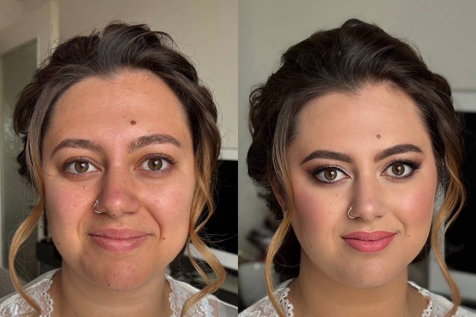 Prima&Dopo Carlotta