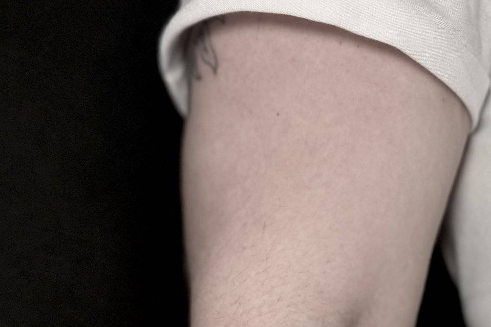 Fine line