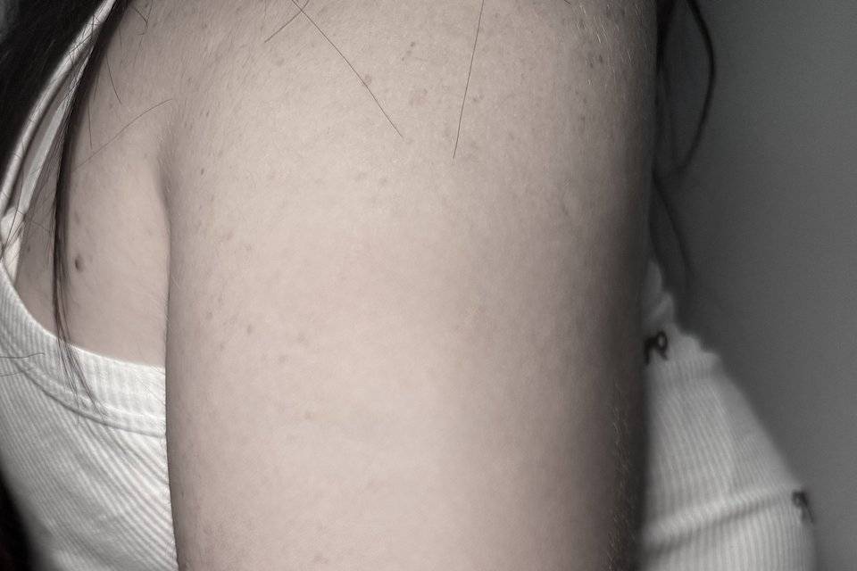 Fine line