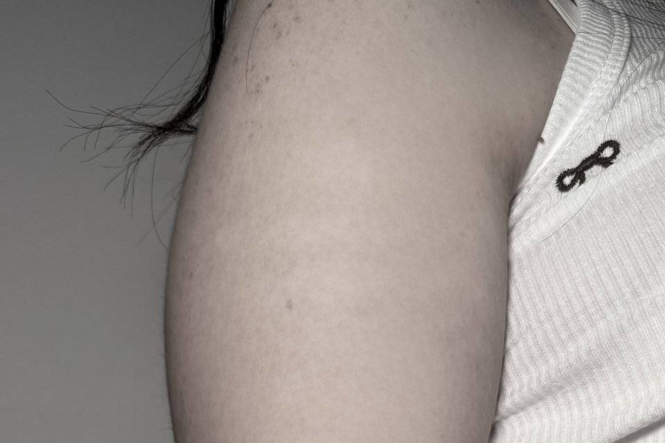 Fine line