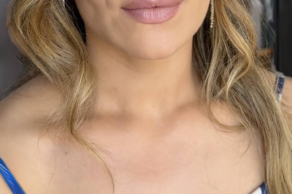 Trucco testimone